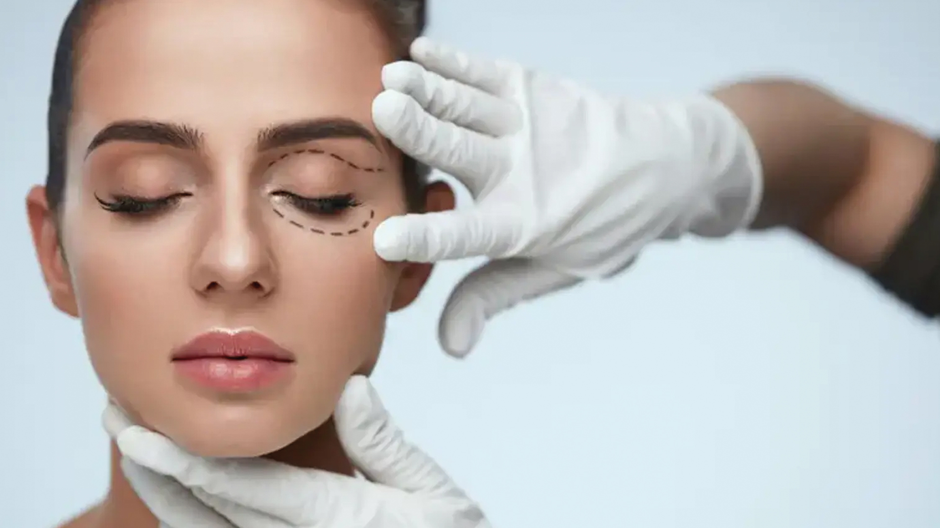 La blépharoplastie :  une chirurgie esthétique du regard  tout en délicatesse