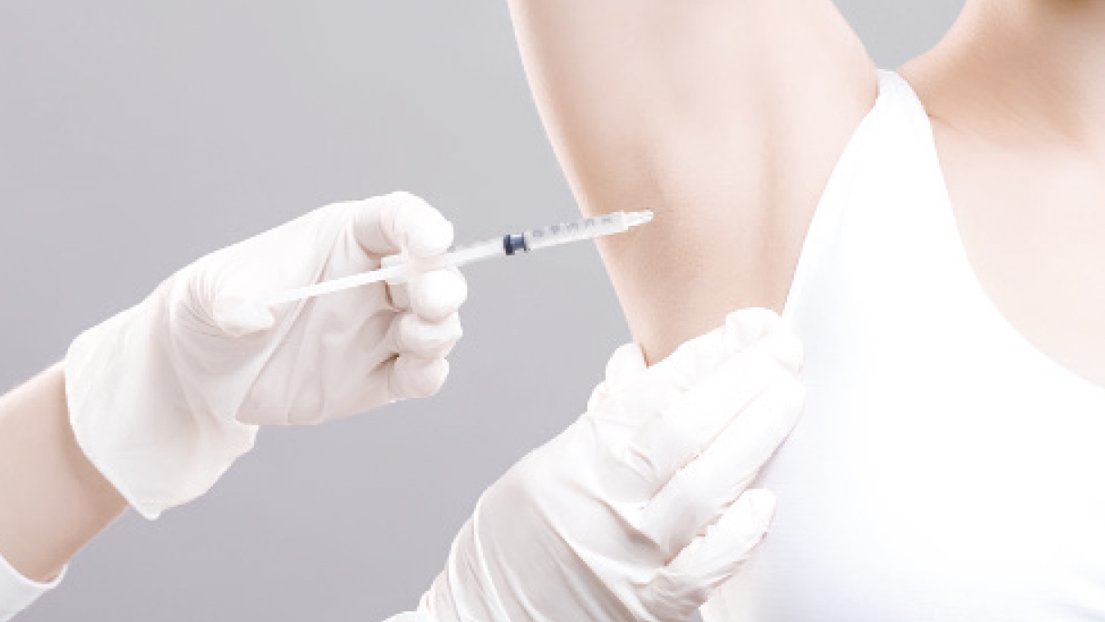 Transpiration excessive :  un été serein grâce au botox