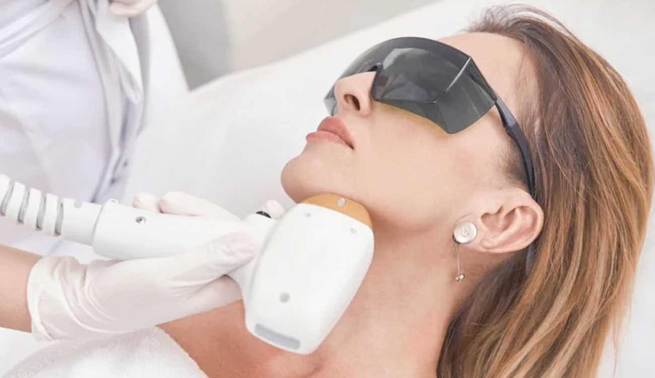 La Perfection Sans Poils:  le laser, signature beauté de haute gamme