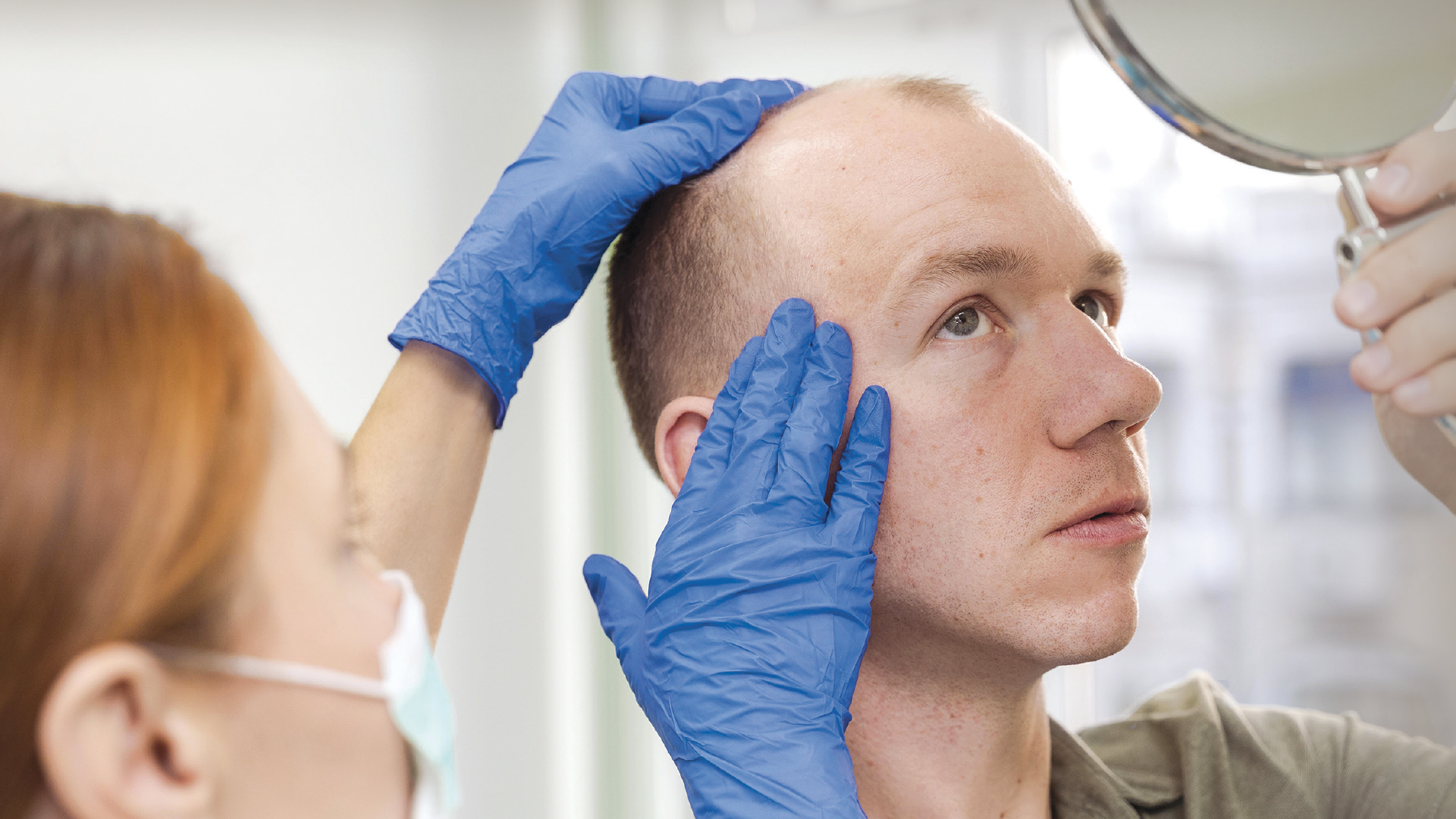 La calvitie décryptée : ce que la science nous apprend