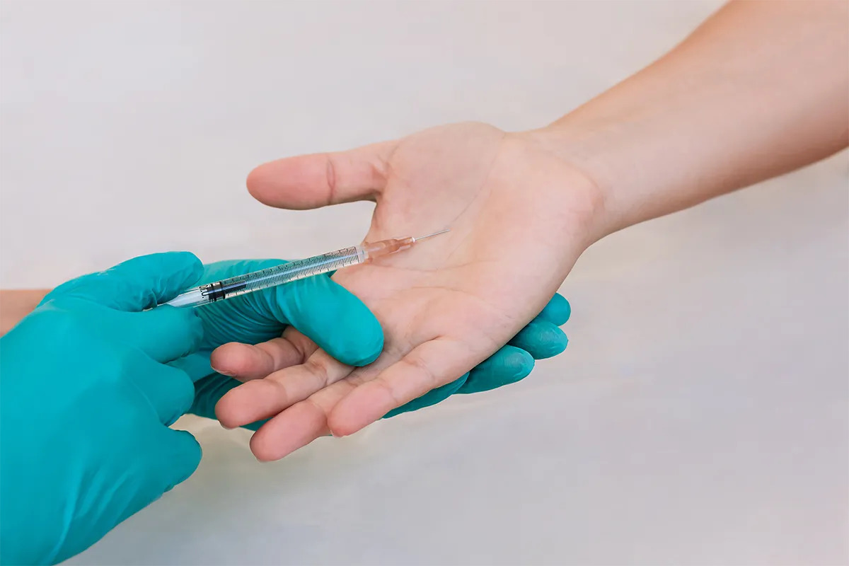 Toxine botulinique : une arme de précision contre l’hyperhidrose